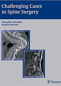 Challenging Cases in Spine Surgery, 1e (Original Publisher PDF)