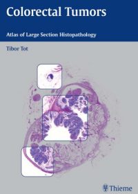 Colorectal Tumors: Atlas of Large Section Histopathology, 1e (Original Publisher PDF)