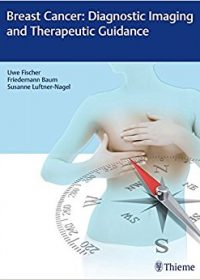 Breast Cancer: Diagnostic Imaging and Therapeutic Guidance, 1e (Original Publisher PDF)