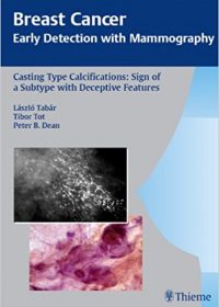 Casting Type Calcifications Sign of a Subtype with Deceptive Features, 1e (Original Publisher PDF)