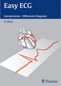 Easy ECG: Interpretation - Differential Diagnosis, 1e (Original Publisher PDF)