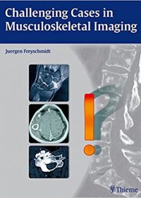 Challenging Cases in Musculoskeletal Imaging, 1e (Original Publisher PDF)