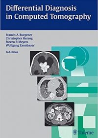 Differential Diagnosis in Computed Tomography, 2e (Original Publisher PDF)