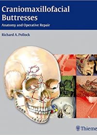 Craniomaxillofacial Buttresses: Anatomy and Operative Repair, 1e (Original Publisher PDF)