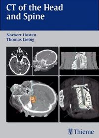 CT of the Head and Spine, 1e (Original Publisher PDF)