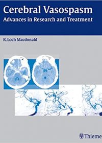 Cerebral Vasospasm: Advances in Research and Treatment, 1e (Original Publisher PDF)