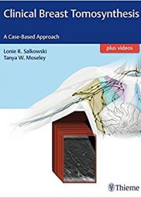 Clinical Breast Tomosynthesis: A Case-Based Approach, 1e (Original Publisher PDF)
