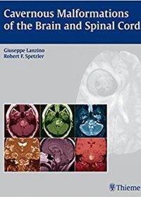 Cavernous Malformations of the Brain and Spinal Cord, 1e (Original Publisher PDF)