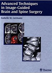 Advanced Techniques in Image-Guided Brain and Spine Surgery, 1e (Original Publisher PDF)