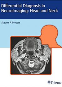Differential Diagnosis in Neuroimaging: Head and Neck, 1e (Original Publisher PDF)