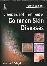 Diagnosis and Treatment of Common Skin Diseases, 4e (True PDF)