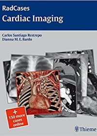 Radcases Cardiac Imaging, 1e (Original Publisher PDF)