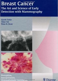 Breast Cancer - The Art and Science of Early Detection with Mammography: Perception, Interpretation, Histopathologic Correlation, 1e (Original Publisher PDF)