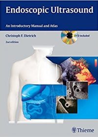 Endoscopic Ultrasound: An Introductory Manual and Atlas, 2e (Original Publisher PDF)