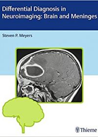 Differential Diagnosis in Neuroimaging: Brain and Meninges, 1e (Original Publisher PDF)