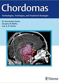 Chordomas: Technologies, Techniques, and Treatment Strategies, 1e (Original Publisher PDF)
