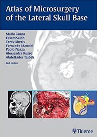 Atlas of Microsurgery of the Lateral Skull Base, 2e (Original Publisher PDF)
