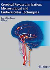 Cerebral Revascularization: Microsurgical and Endovascular Techniques, 1e (Original Publisher PDF)