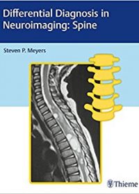 Differential Diagnosis in Neuroimaging: Spine, 1e (Original Publisher PDF)