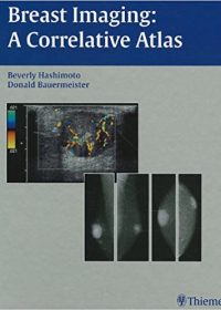 Breast Imaging: A Correlative Atlas, 1e (Original Publisher PDF)