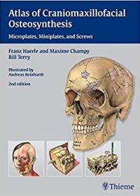 Atlas of Craniomaxillofacial Osteosynthesis: Microplates, Miniplates,and Screws, 2e (Original Publisher PDF)