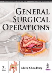 General Surgical Operations, 2e (True PDF)