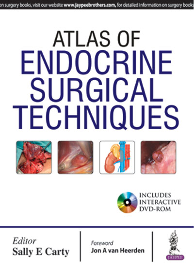 Atlas of Endocrine Surgical Techniques, 1e (True PDF)