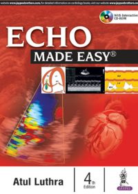 Echo Made Easy, 4e (True PDF)