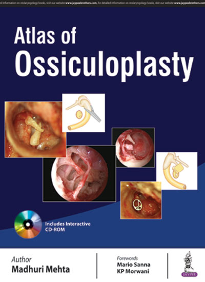 Atlas of Ossiculoplasty, 1e (True PDF)