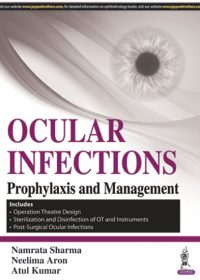 Ocular Infections: Prophylaxis and Management, 1e (True PDF)