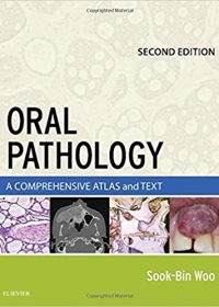Oral Pathology: A Comprehensive Atlas and Text, 2e (Original Publisher PDF)
