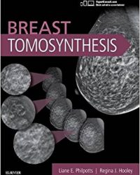 Breast Tomosynthesis, 1e (Original Publisher PDF)