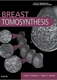 Breast Tomosynthesis, 1e (Original Publisher PDF)