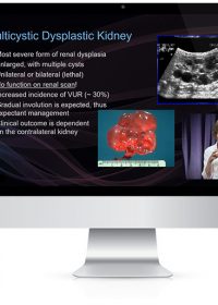 Medstudy Pediatrics Board Review 2018 (Videos)