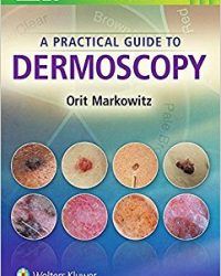 A Practical Guide to Dermoscopy, 1e (EPUB)