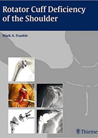 Rotator Cuff Deficiency of the Shoulder, 1e (Original Publisher PDF)