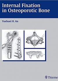 Internal Fixation in Osteoporotic Bone, 1e (Original Publisher PDF)