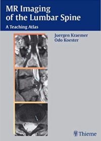 MR Imaging of the Lumbar Spine: A Teaching Atlas, 1e (Original Publisher PDF)
