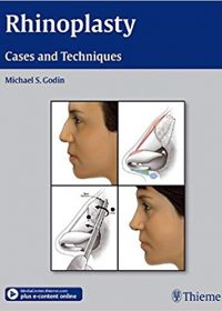 Rhinoplasty - Cases and Techniques. 1e (Original Publisher PDF)