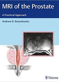 MRI of the Prostate: A Practical Approach, 1e (Original Publisher PDF)