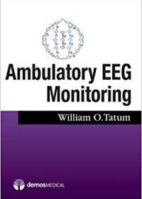 Ambulatory EEG, 1e (Original Publisher PDF)