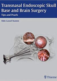 Transnasal Endoscopic Skull Base and Brain Surgery: Tips and Pearls, 1e (Original Publisher PDF)