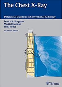 The Chest X-Ray (Differential Diagnosis in Conventional Radiology), 1e (Original Publisher PDF)