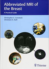 Abbreviated MRI of the Breast: A Practical Guide, 1e (Original Publisher PDF)