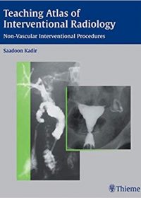 Teaching Atlas of Interventional Radiology: Non-Vascular Interventional Procedures, 1e (Original Publisher PDF)