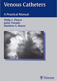 Venous Catheters: A Practical Manual, 1e (Original Publisher PDF)