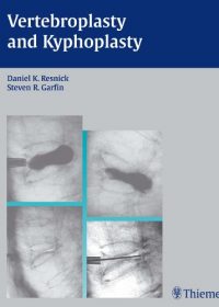 Vertebroplasty and Kyphoplasty, 1e (Original Publisher PDF)