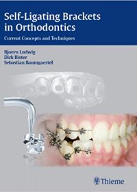 Self-ligating Brackets in Orthodontics: Current Concepts and Techniques, 1e (Original Publisher PDF)