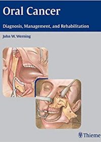 Oral Cancer: Diagnosis, Management, and Rehabilitation, 1e (Original Publisher PDF)