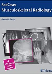 Radcases Musculoskeletal Radiology, 1e (Original Publisher PDF)